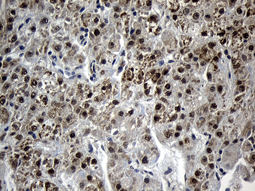 m07965 anti mag1 gpat3 mouse monoclonal antibody clone id oti1d11 ihc testing 3