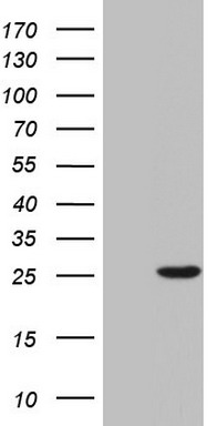 HEK293T cells were transfected with the pCMV6-ENTRY control (Left lane) or pCMV6-ENTRY SPA17 (Right lane) cDNA for 48 hrs and lysed