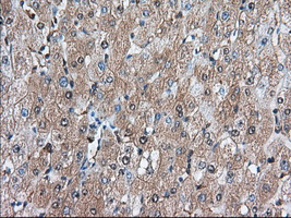 Immunohistochemical staining of paraffin-embedded Human liver tissue within the normal limits using anti-BDH2 mouse monoclonal antibody. (Heat-induced epitope retrieval by 10mM citric buffer