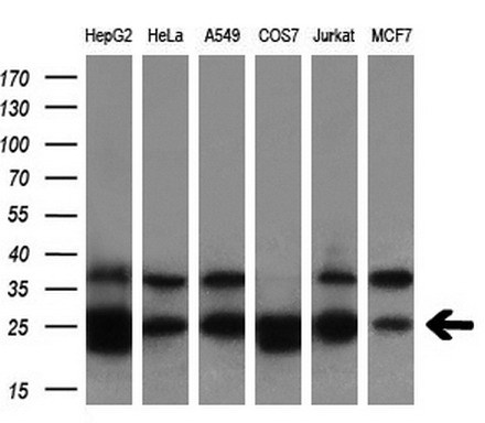 Western blot analysis of extracts (10ug) from 6 different cell lines by using anti-BDH2 monoclonal antibody (1:200).