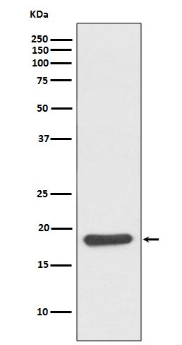 Western blot analysis of Hsp20 expression in mouse skeletal muscle lysate
