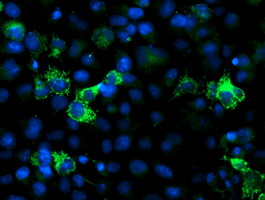 m07995 anti nudt9 mouse monoclonal antibody clone id oti7a12 if testing 7