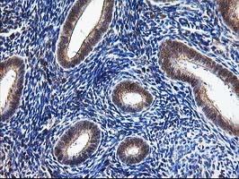 Immunohistochemical staining of paraffin-embedded Human endometrium tissue within the normal limits using anti-NUDT9 mouse monoclonal antibody