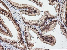 m07995 anti nudt9 mouse monoclonal antibody clone id oti7a12 ihc testing 4