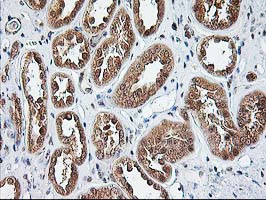 m07995 anti nudt9 mouse monoclonal antibody clone id oti7a12 ihc testing 5