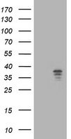 HEK293T cells were transfected with the pCMV6-ENTRY control (Left lane) or pCMV6-ENTRY NUDT9 (Right lane) cDNA for 48 hrs and lysed