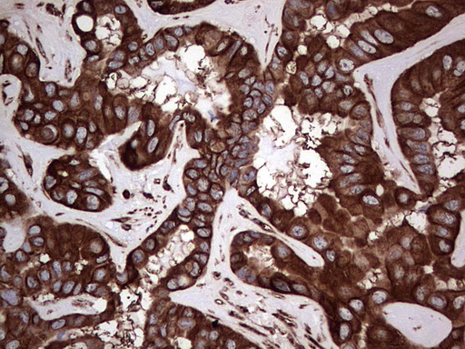 m08006 anti lrrtm1 mouse monoclonal antibody clone id oti5h9 ihc testing 4