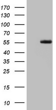 HEK293T cells were transfected with the pCMV6-ENTRY control (Left lane) or pCMV6-ENTRY LRRTM1 (Right lane) cDNA for 48 hrs and lysed