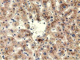 Immunohistochemical staining of paraffin-embedded Human liver tissue within the normal limits using anti-THOP1 mouse monoclonal antibody