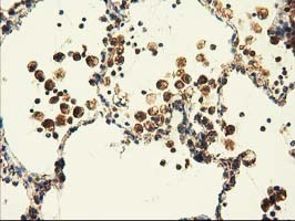 m08019 1 anti ak3 mouse monoclonal antibody clone id oti6b7 ihc testing 3