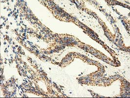 m08019 1 anti ak3 mouse monoclonal antibody clone id oti6b7 ihc testing 4