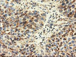 m08019 1 anti ak3 mouse monoclonal antibody clone id oti6b7 ihc testing 5