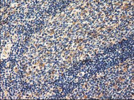 m08019 1 anti ak3 mouse monoclonal antibody clone id oti6b7 ihc testing 6
