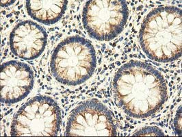 m08019 1 anti ak3 mouse monoclonal antibody clone id oti6b7 ihc testing 7