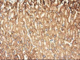 m08019 1 anti ak3 mouse monoclonal antibody clone id oti6b7 ihc testing 8