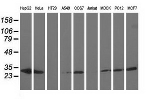 m08019 1 anti ak3 mouse monoclonal antibody clone id oti6b7 wb testing 2
