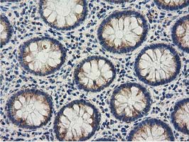 Immunohistochemical staining of paraffin-embedded Human colon tissue within the normal limits using anti-AK3 mouse monoclonal antibody
