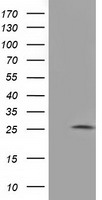 HEK293T cells were transfected with the pCMV6-ENTRY control (Left lane) or pCMV6-ENTRY AK3 (Right lane) cDNA for 48 hrs and lysed