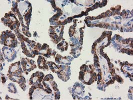 m08019 anti ak3 mouse monoclonal antibody clone id oti5a1 ihc testing 4