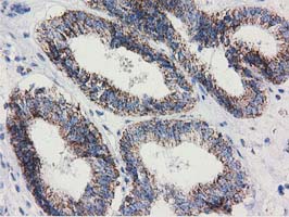 m08019 anti ak3 mouse monoclonal antibody clone id oti5a1 ihc testing 5