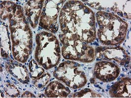 m08019 anti ak3 mouse monoclonal antibody clone id oti5a1 ihc testing 6