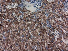 m08019 anti ak3 mouse monoclonal antibody clone id oti5a1 ihc testing 7