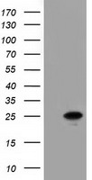 HEK293T cells were transfected with the pCMV6-ENTRY control (Left lane) or pCMV6-ENTRY AK3 (Right lane) cDNA for 48 hrs and lysed