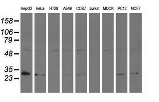 Western blot analysis of extracts (35ug) from 9 different cell lines by using anti-AK3 monoclonal antibody