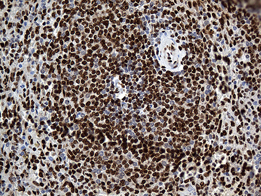 m08020 anti rod1 ptbp3 mouse monoclonal antibody clone id oti5g7 ihc testing 10