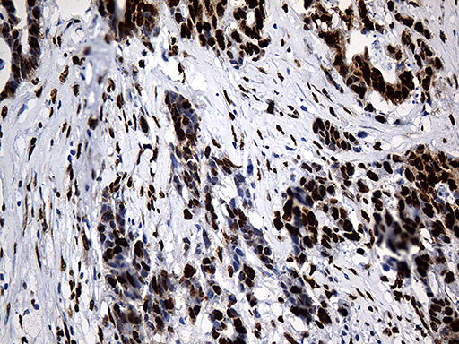 m08020 anti rod1 ptbp3 mouse monoclonal antibody clone id oti5g7 ihc testing 11