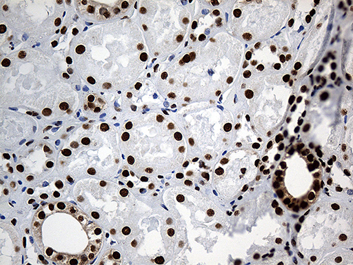 m08020 anti rod1 ptbp3 mouse monoclonal antibody clone id oti5g7 ihc testing 12