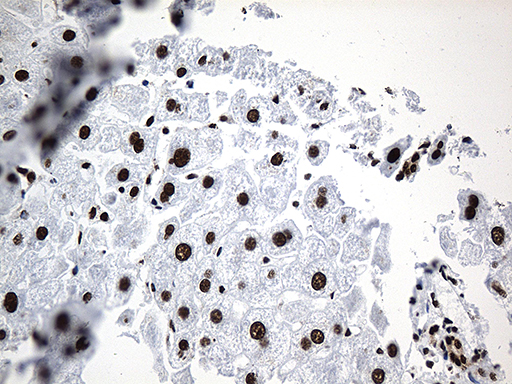 m08020 anti rod1 ptbp3 mouse monoclonal antibody clone id oti5g7 ihc testing 13