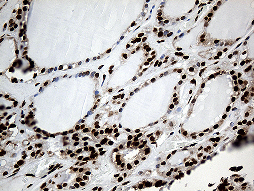 m08020 anti rod1 ptbp3 mouse monoclonal antibody clone id oti5g7 ihc testing 4