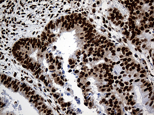 m08020 anti rod1 ptbp3 mouse monoclonal antibody clone id oti5g7 ihc testing 5