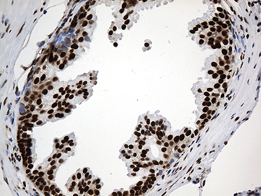 m08020 anti rod1 ptbp3 mouse monoclonal antibody clone id oti5g7 ihc testing 7