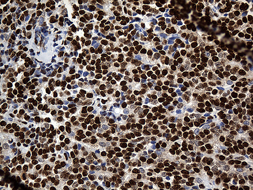 m08020 anti rod1 ptbp3 mouse monoclonal antibody clone id oti5g7 ihc testing 8
