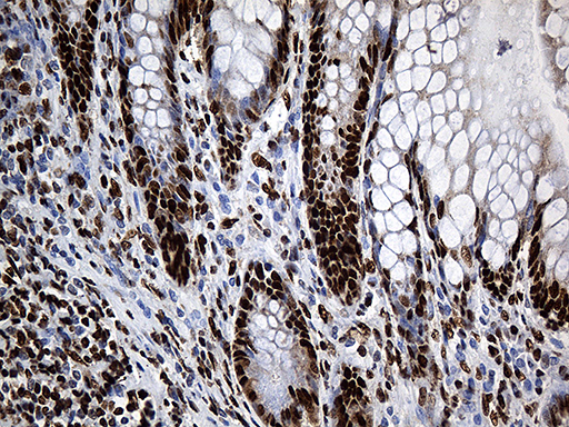 m08020 anti rod1 ptbp3 mouse monoclonal antibody clone id oti5g7 ihc testing 9