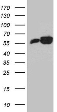 HEK293T cells were transfected with the pCMV6-ENTRY control (Left lane) or pCMV6-ENTRY PTBP3 (Right lane) cDNA for 48 hrs and lysed