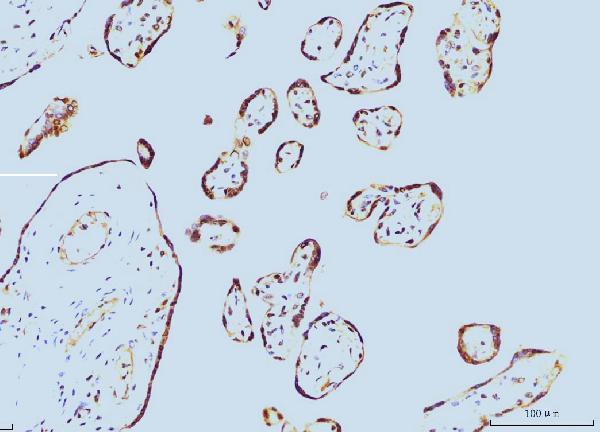 IHC analysis of Cyclophilin E/PPIE using anti-Cyclophilin E/PPIE antibody (M08021-1)