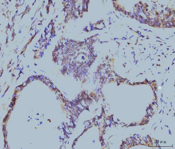  IHC analysis of Cyclophilin E/PPIE using anti-Cyclophilin E/PPIE antibody (M08021-1)