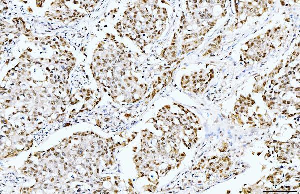  IHC analysis of Cyclophilin E/PPIE using anti-Cyclophilin E/PPIE antibody (M08021)
