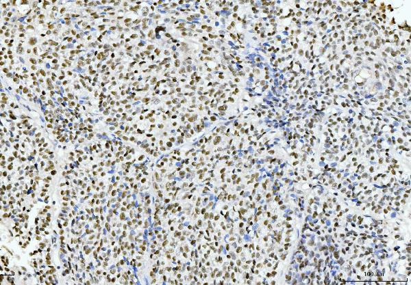  IHC analysis of Cyclophilin E/PPIE using anti-Cyclophilin E/PPIE antibody (M08021)