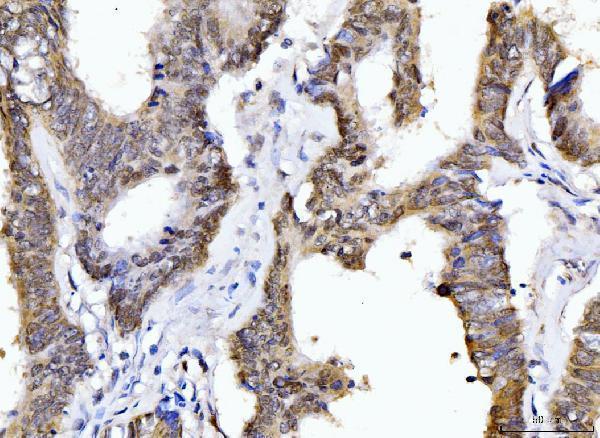 m08021 ppie primary antibodies ihc testing 8