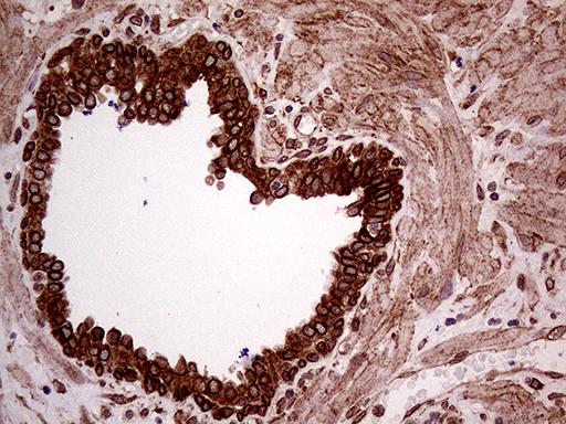 m08034 anti erlin1 mouse monoclonal antibody clone id oti4b1 ihc testing 3
