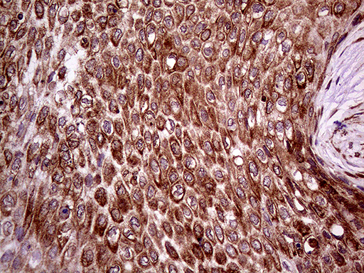 m08034 anti erlin1 mouse monoclonal antibody clone id oti4b1 ihc testing 4