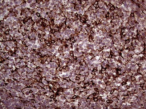 m08034 anti erlin1 mouse monoclonal antibody clone id oti4b1 ihc testing 5