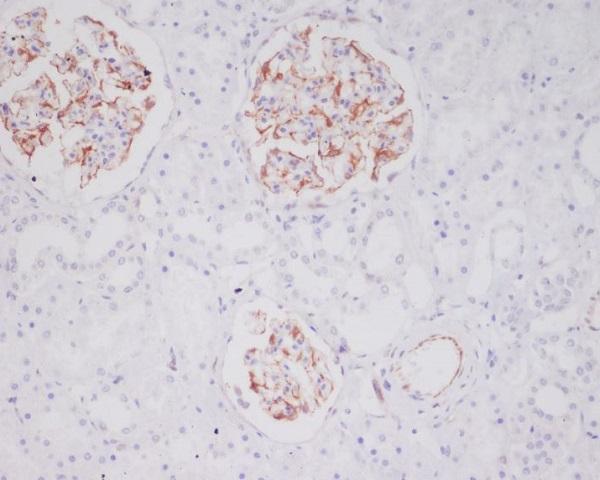 m08039 ihc