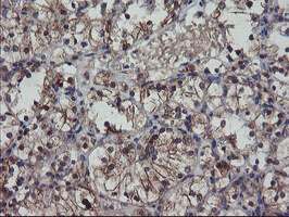 m08073 1 anti pfdn3 vbp1 mouse monoclonal antibody clone id oti1a5 ihc testing 10
