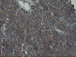 m08073 1 anti pfdn3 vbp1 mouse monoclonal antibody clone id oti1a5 ihc testing 4