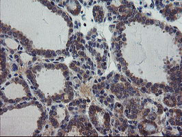 m08073 1 anti pfdn3 vbp1 mouse monoclonal antibody clone id oti1a5 ihc testing 5